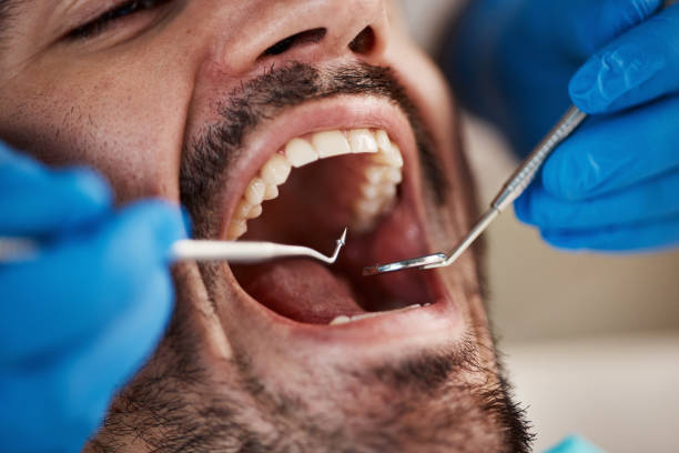Best Weekend Emergency Dentist in Mccook, NE